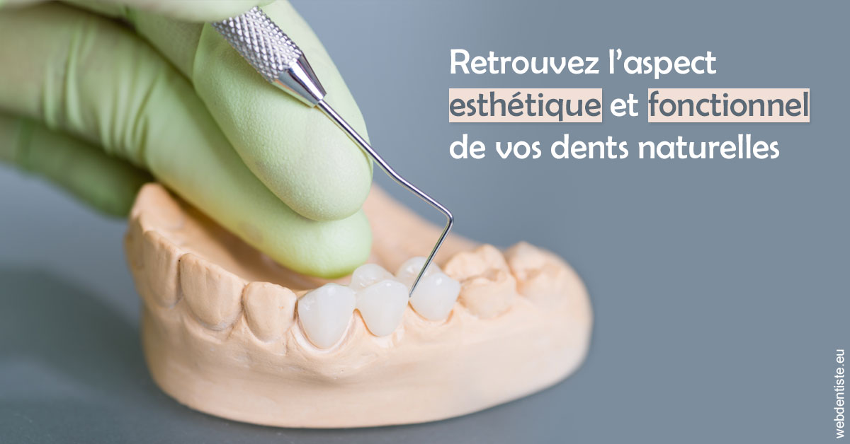 https://dr-bibas-alain.chirurgiens-dentistes.fr/Restaurations dentaires 1