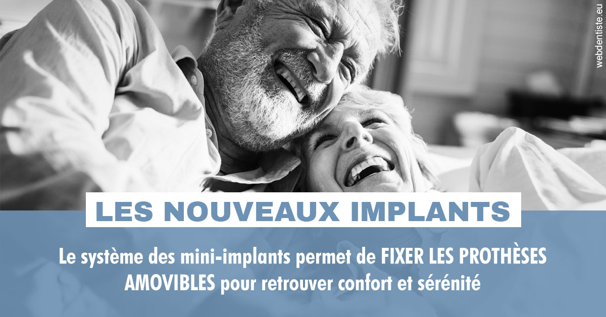 https://dr-bibas-alain.chirurgiens-dentistes.fr/Les nouveaux implants 2