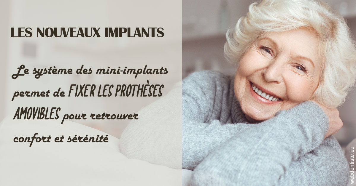 https://dr-bibas-alain.chirurgiens-dentistes.fr/Les nouveaux implants 1