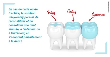 https://dr-bibas-alain.chirurgiens-dentistes.fr/L'INLAY ou l'ONLAY
