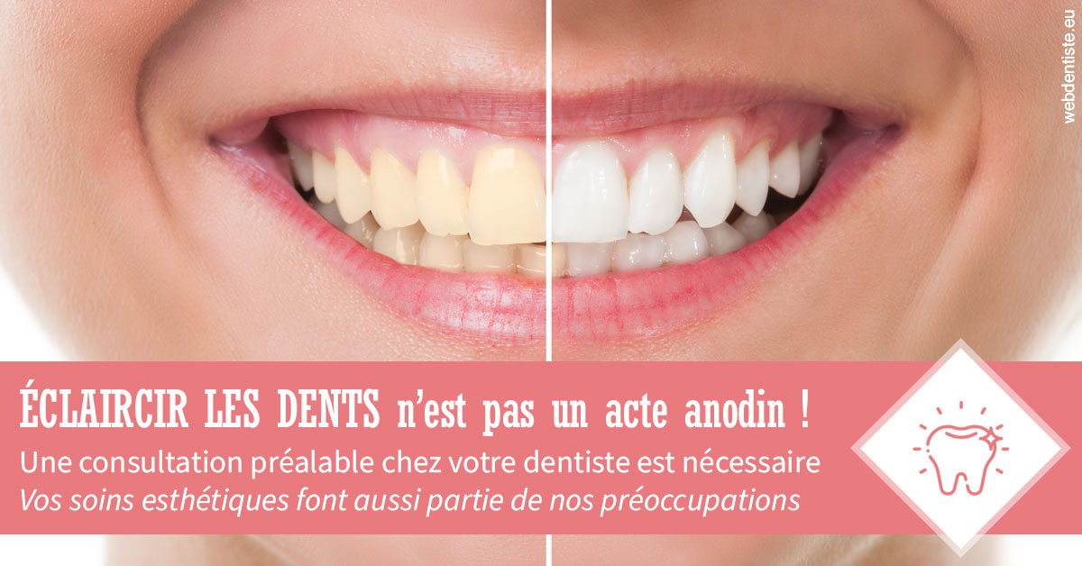 https://dr-bibas-alain.chirurgiens-dentistes.fr/Eclaircir les dents 1
