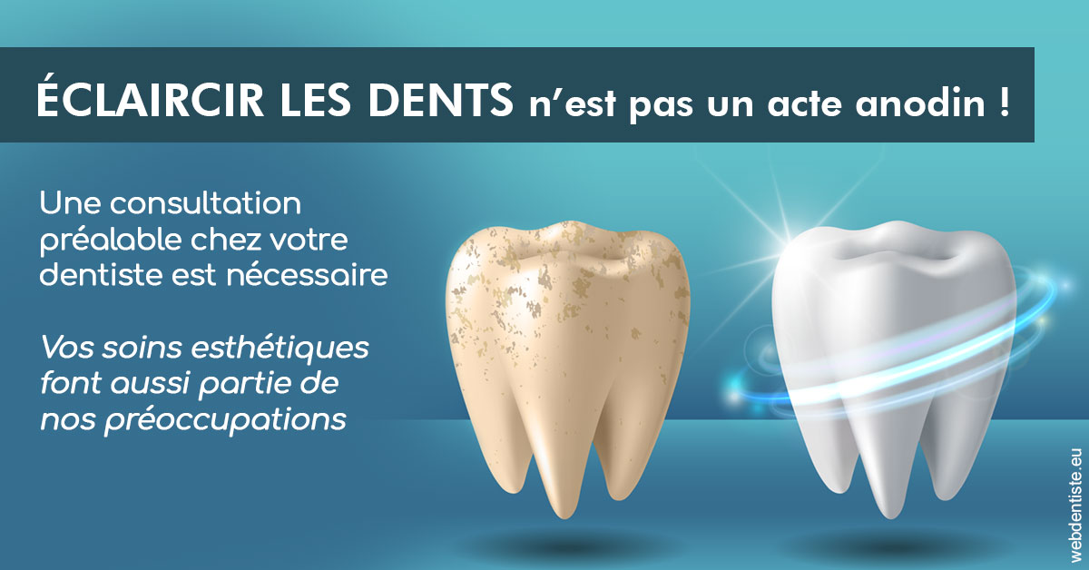 https://dr-bibas-alain.chirurgiens-dentistes.fr/Eclaircir les dents 2