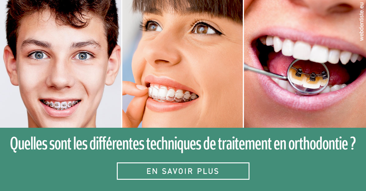 https://dr-bibas-alain.chirurgiens-dentistes.fr/Les différentes techniques de traitement 2