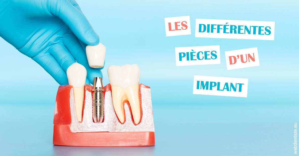 https://dr-bibas-alain.chirurgiens-dentistes.fr/Les différentes pièces d’un implant 2