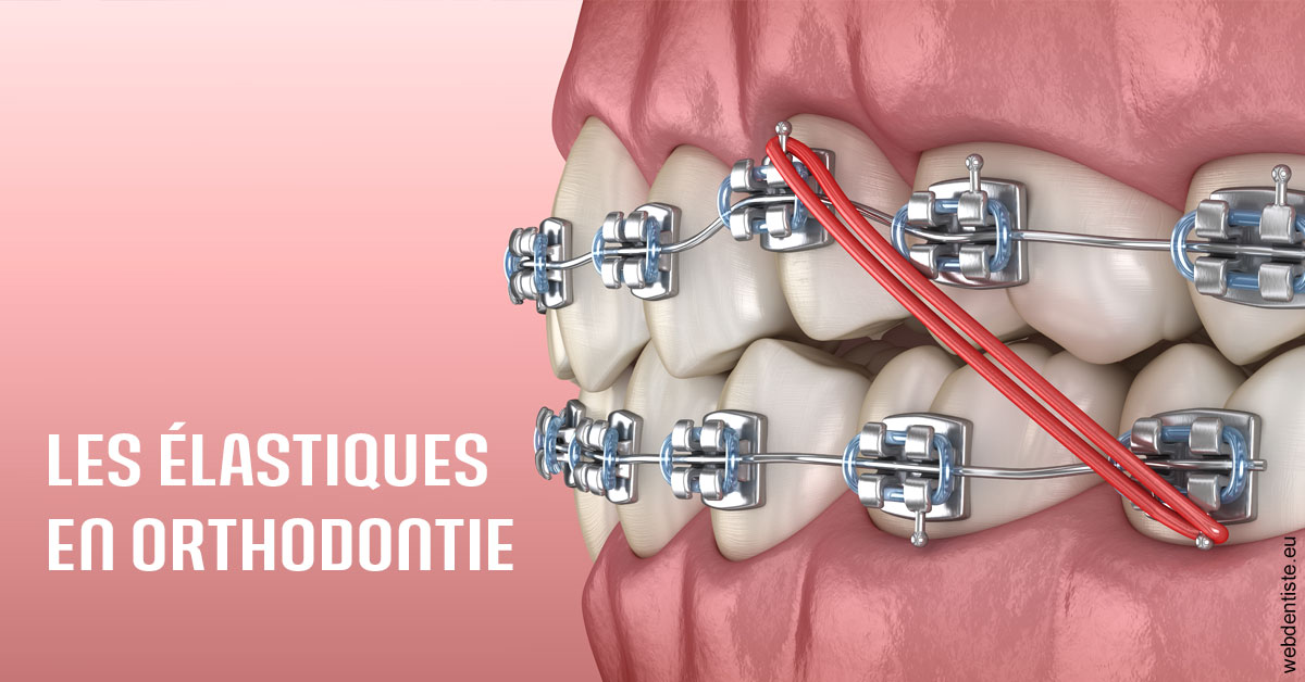 https://dr-bibas-alain.chirurgiens-dentistes.fr/Elastiques orthodontie 2