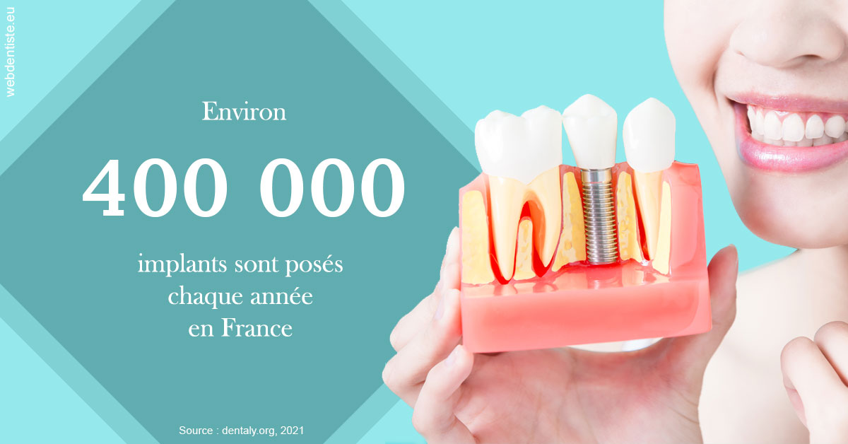 https://dr-bibas-alain.chirurgiens-dentistes.fr/Pose d'implants en France 2