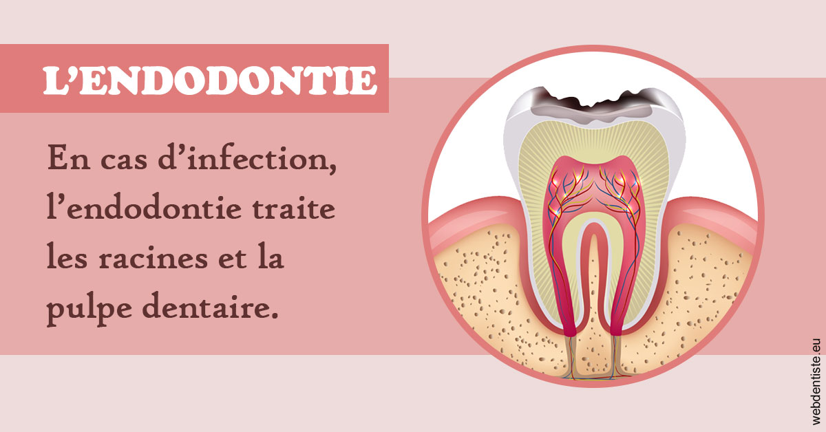 https://dr-bibas-alain.chirurgiens-dentistes.fr/L'endodontie 2